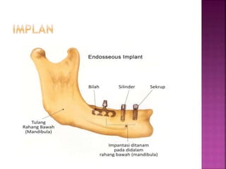 Tulang dan Persendian