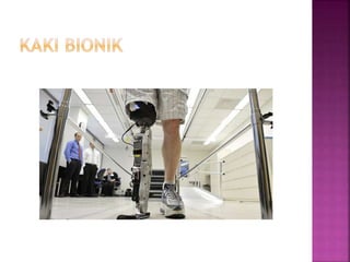 Tulang dan Persendian