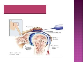 Tulang dan Persendian