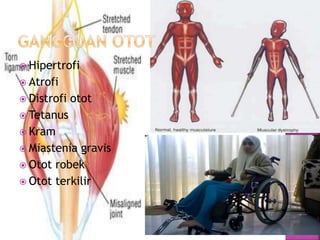  Hipertrofi
 Atrofi
 Distrofi otot
 Tetanus
 Kram
 Miastenia gravis
 Otot robek
 Otot terkilir
 