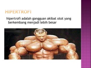 hipertrofi adalah gangguan akibat otot yang
berkembang menjadi lebih besar
 