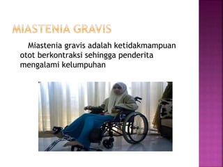Miastenia gravis adalah ketidakmampuan
otot berkontraksi sehingga penderita
mengalami kelumpuhan
 