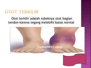 Otot terkilir adalah robeknya otot bagian
tendon karena tegang melebihi batas normal
 