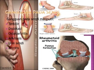 Gangguan pada sendi meliputi:
 Terkilir
 Dislokasi
 Osteoartritis
 Ankilosis
 Urai sendi
 artritis
 