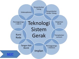 Teknologi
Sistem
Gerak
Penyembuhan
Tulang
Penyembuhan
Kanker Tulang
Pergantian
Sendi
Transplantasi
sumsum
Penanggulanga
n Skoliosis
Implan
Tangan Kaki
Bionik
Kursi
Roda
Penanggulanga
n kaki O
Viskosuplemen
NEXT
 