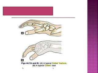 Tulang dan Persendian