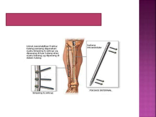 Tulang dan Persendian