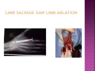 Tulang dan Persendian