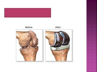 Tulang dan Persendian