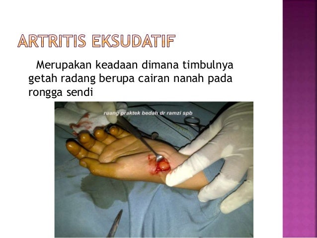 Tulang dan Persendian