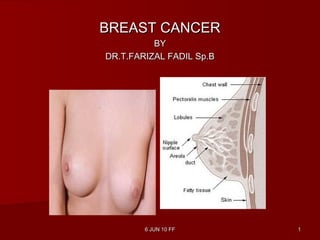 6 JUN 10 FF6 JUN 10 FF 11
BREAST CANCERBREAST CANCER
BYBY
DR.T.FARIZAL FADIL Sp.BDR.T.FARIZAL FADIL Sp.B
 