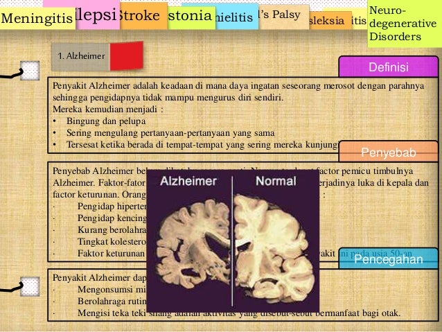 Penyakit pada sistem saraf