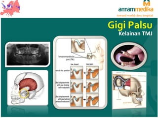 toward world class hospital

Gigi Palsu

Kelainan TMJ

 