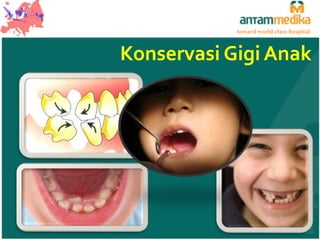 toward world class hospital

Konservasi Gigi Anak

 