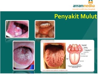 toward world class hospital
toward world class hospital

Penyakit Anak
Konservasi Gigi Mulut

 