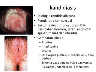 kandidiasis
• Etiologi : candida albicans
• Penularan : non seksual
• Faktor resiko : imunosupresi, DM,
perubahan hormon, terapi antibiotik
spektrum luas dan obesitas
• Gambaran klinis :
– Pruritus
– Iritasi vagina
– Disuria
– Duh vagina putih susu seperti keju, tidak
berbau
– Eritema pada dinding vulva dan vagina
– Ekskoriasi, edema labia, lichenifikasi
 
