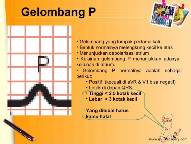 Unduh 91 Gambar Gelombang Ekg Normal  