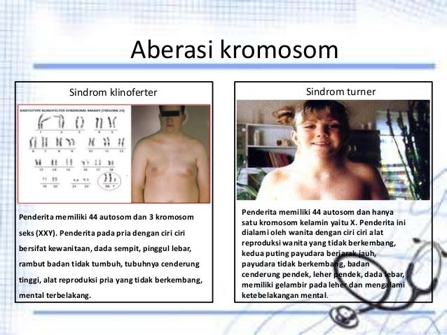 Presentasi gambar kelainan genetik