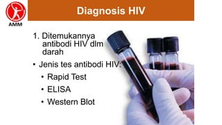 Diagnosis HIV
1. Ditemukannya
antibodi HIV dlm
darah
• Jenis tes antibodi HIV:
• Rapid Test
• ELISA
• Western Blot
 
