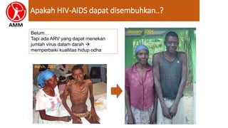 Apakah HIV-AIDS dapat disembuhkan..?
Belum…
Tapi ada ARV yang dapat menekan
jumlah virus dalam darah 
memperbaiki kuallitas hidup odha
 