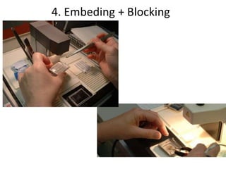 4. Embeding + Blocking
 