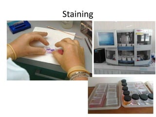 Staining
 