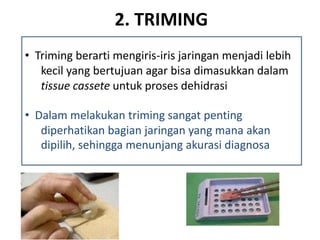 2. TRIMING
• Triming berarti mengiris-iris jaringan menjadi lebih
kecil yang bertujuan agar bisa dimasukkan dalam
tissue cassete untuk proses dehidrasi
• Dalam melakukan triming sangat penting
diperhatikan bagian jaringan yang mana akan
dipilih, sehingga menunjang akurasi diagnosa
 