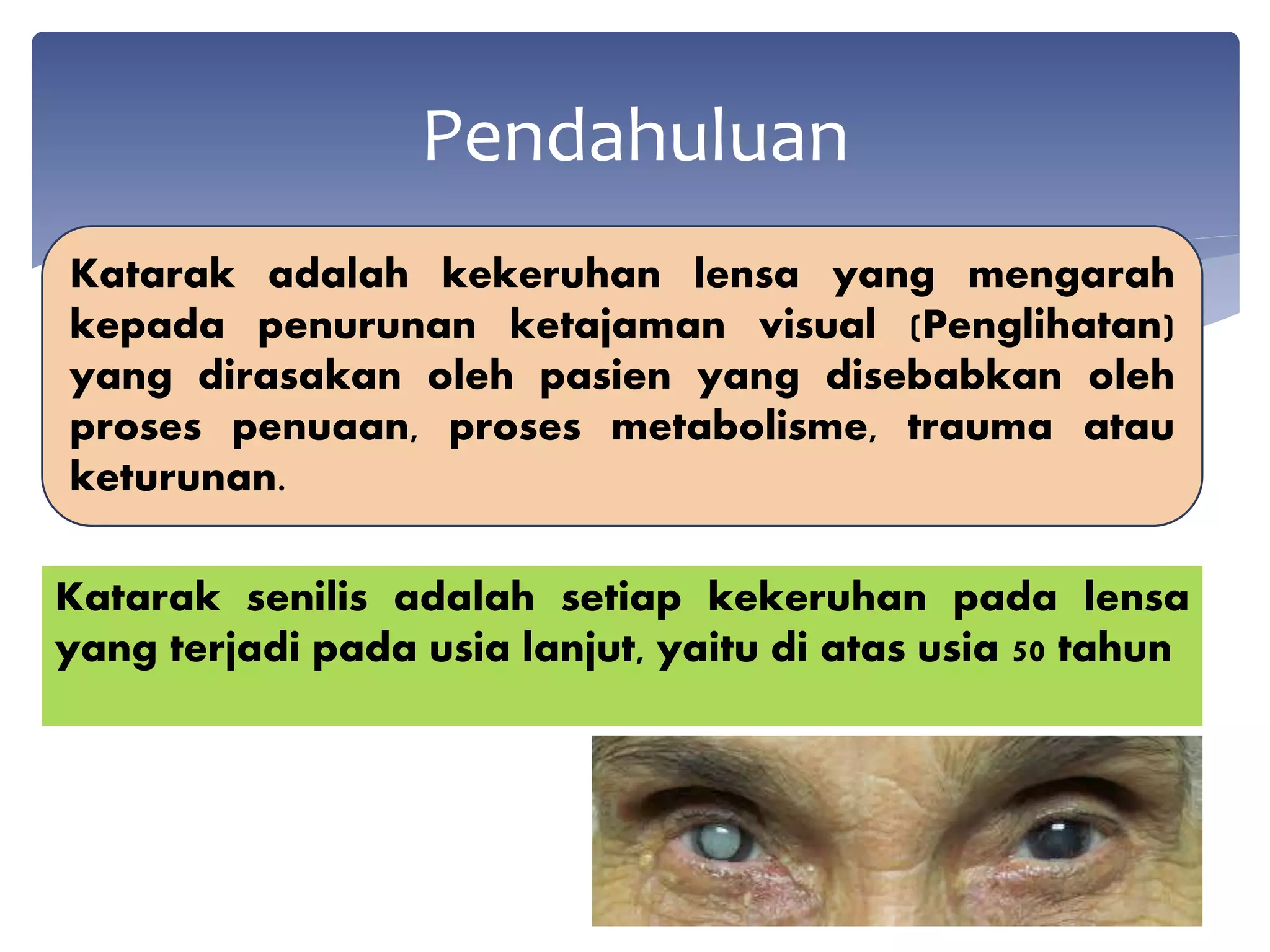 Katarak senilis adalah setiap kekeruhan pada lensa
yang terjadi pada usia lanjut, yaitu di atas usia 50 tahun
Pendahuluan
Katarak adalah kekeruhan lensa yang mengarah
kepada penurunan ketajaman visual (Penglihatan)
yang dirasakan oleh pasien yang disebabkan oleh
proses penuaan, proses metabolisme, trauma atau
keturunan.