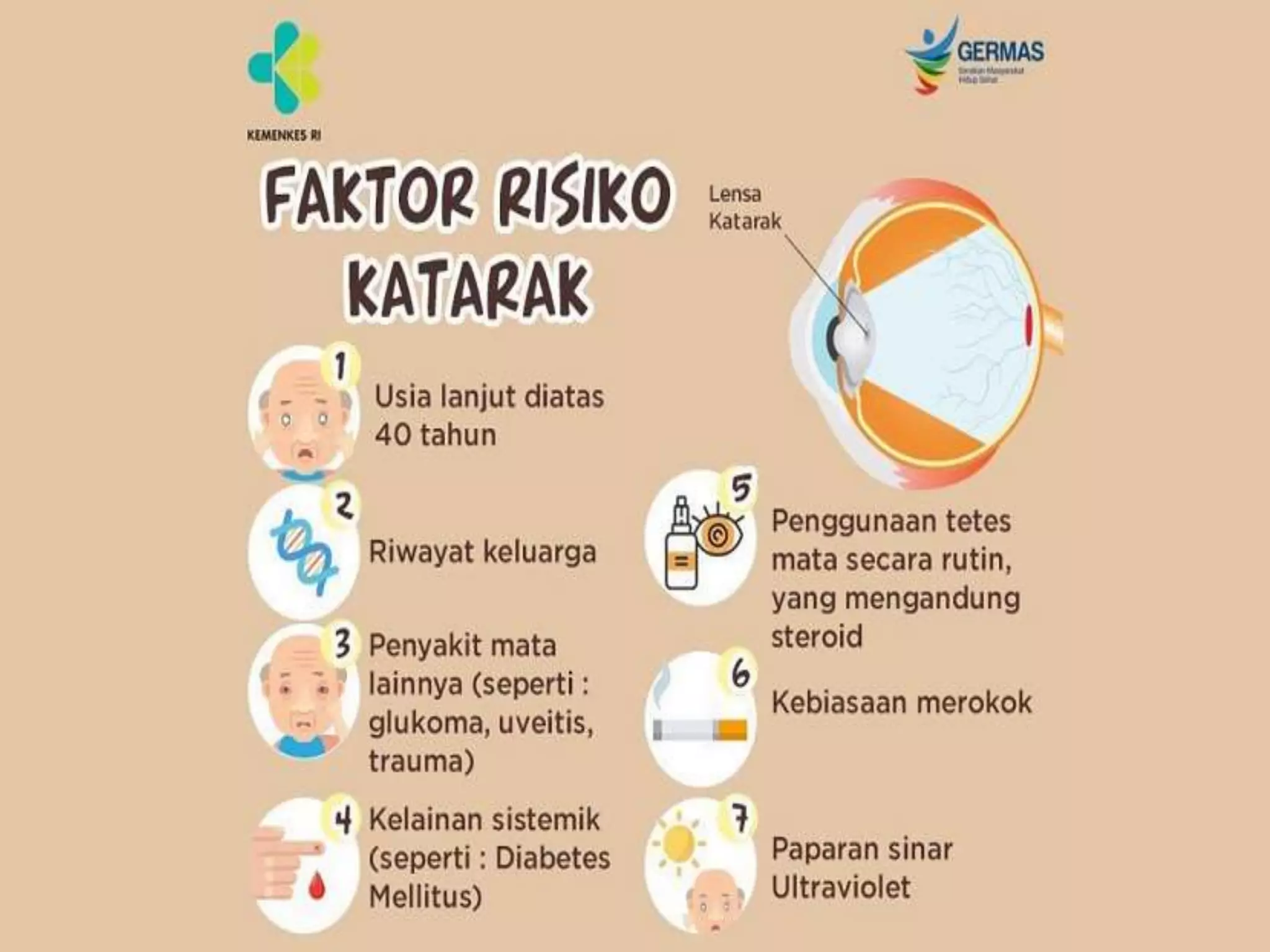 Faktor Resiko
Katarak adalah penyakit degeneratif yang
dipengaruhi oleh beberapa faktor, yaitu:
Usia
Jenis Kelamin
Riwayat Penyakit --DM