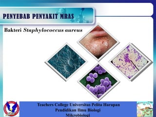 PENYEBAB PENYAKIT MRAS
Teachers College Universitas Pelita Harapan
Pendidikan Ilmu Biologi
Mikrobiologi
Bakteri Staphylococcus aureus
 