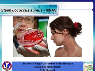 Staphylococcus aureus - MRAS
Teachers College Universitas Pelita Harapan
Pendidikan Ilmu Biologi
Mikrobiologi
 