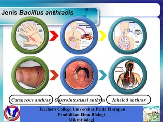 Cutaneous anthrax Gastrointestinal anthrax Inhaled anthrax
Jenis Bacillus anthracis
Teachers College Universitas Pelita Harapan
Pendidikan Ilmu Biologi
Mikrobiologi
 