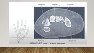 PRESENTASI CT Scan MANUS untuk melihat kelainan | PPTX