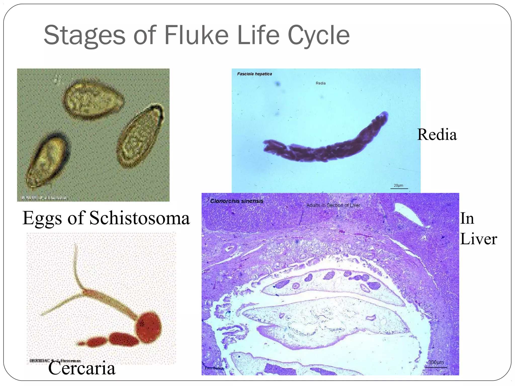 Stages of Fluke Life Cycle

Redia

Eggs of Schistosoma

Cercaria

In
Liver

 