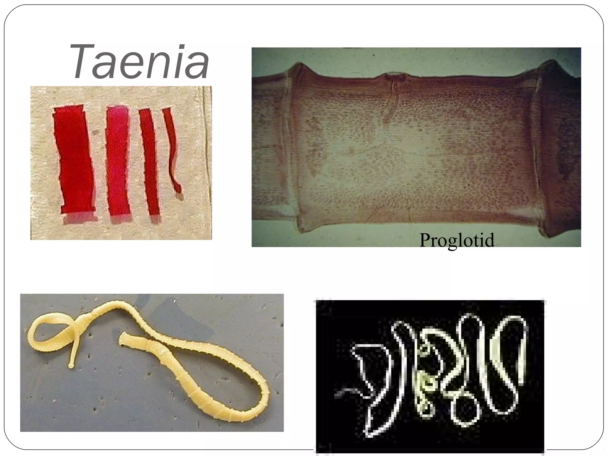 Taenia

Proglotid

 