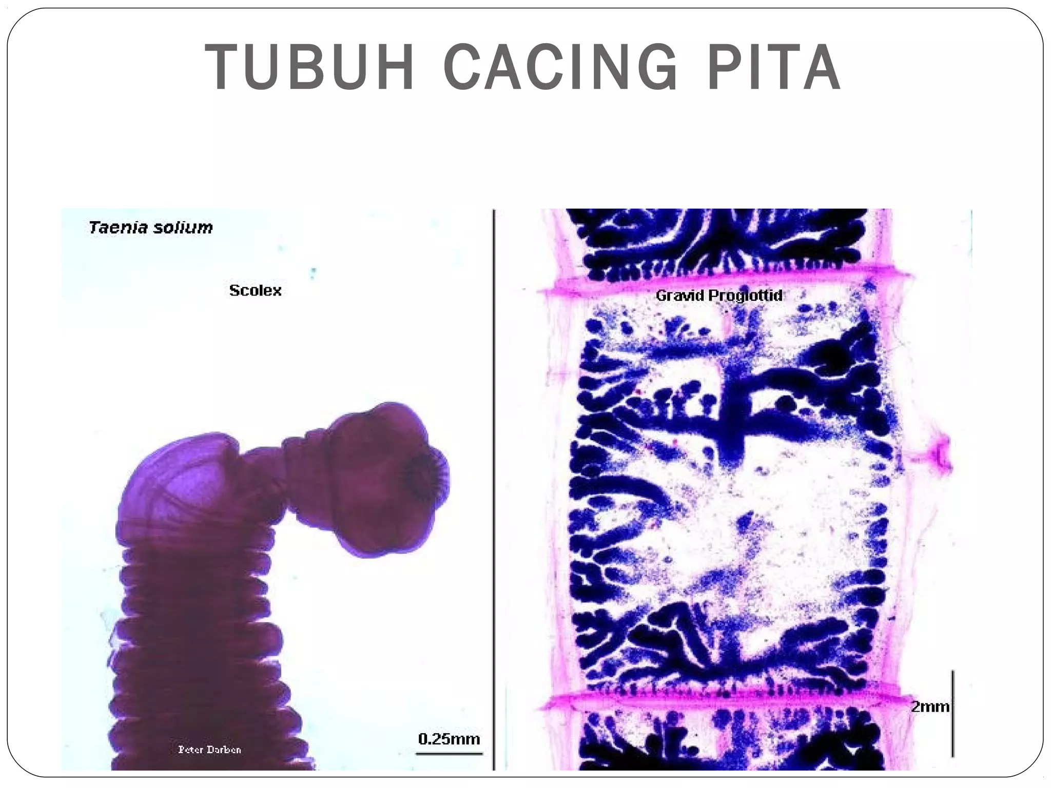 TUBUH CACING PITA

 