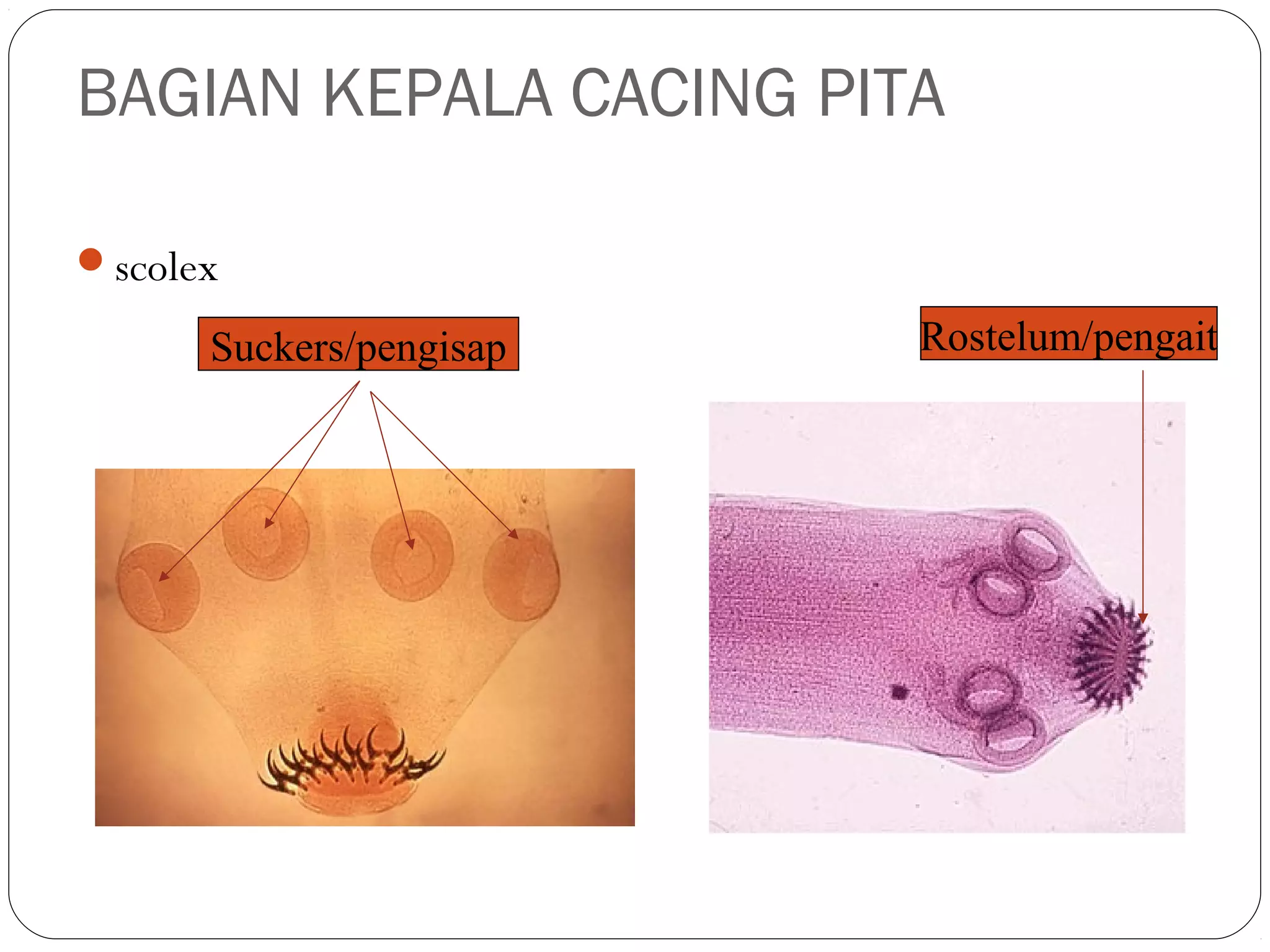 BAGIAN KEPALA CACING PITA
scolex

Suckers/pengisap

Rostelum/pengait

 