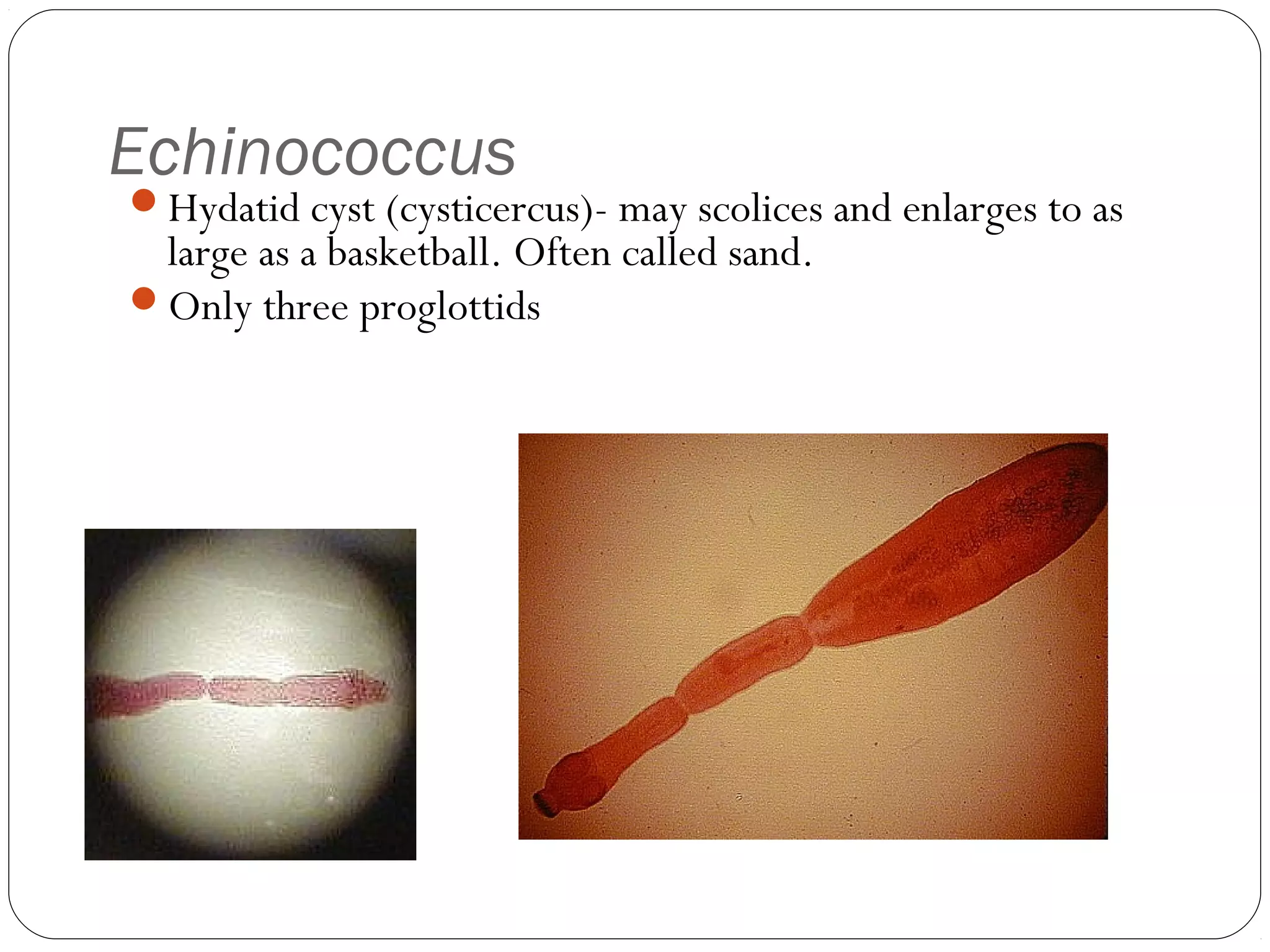 Echinococcus

Hydatid cyst (cysticercus)- may scolices and enlarges to as

large as a basketball. Often called sand.
Only three proglottids

 
