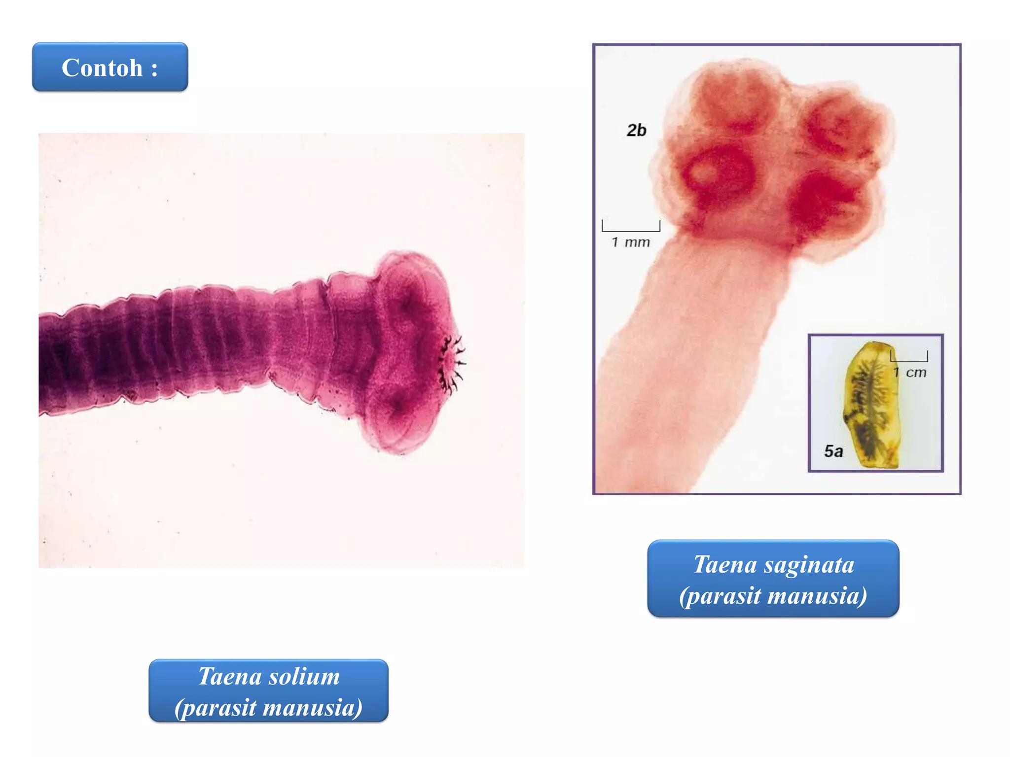 Contoh :
Taena solium
(parasit manusia)
Taena saginata
(parasit manusia)
 