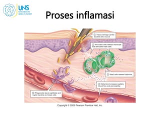 Proses inflamasi
 