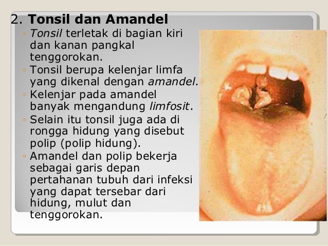 Contoh Transportasi Difusi - Get Damen