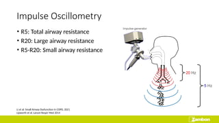 Presentasi Small airways, Large impact.pptx