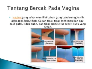  vagina yang sehat memiliki cairan yang cenderung jernih
atau agak keputihan. Cairan tidak tidak menimbulkan bau,
rasa gatal, tidak putih, dan tidak bertekstur sepeti susu yang
pecah.
 