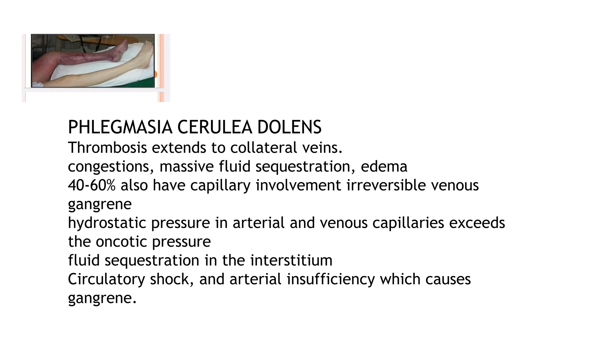 PHLEGMASIA CERULEA DOLENS
Thrombosis extends to collateral veins.
congestions, massive fluid sequestration, edema
40-60% also have capillary involvement irreversible venous
gangrene
hydrostatic pressure in arterial and venous capillaries exceeds
the oncotic pressure
fluid sequestration in the interstitium
Circulatory shock, and arterial insufficiency which causes
gangrene.
 