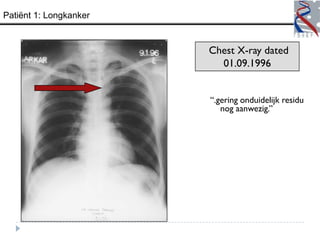 Patiënt 1: Longkanker


                        Chest X-ray dated
                          01.09.1996


                        “.gering onduidelijk residu
                           nog aanwezig.”
 