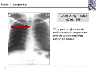 Patiënt 1: Longkanker



                              Chest X-ray dated
                                 07.01.1999

                        “Er is geen terugkeer van de
                        mediastinale massa opgetreden
                        sinds de laatste röntgenfoto
                        Longen zijn schoon.”
 