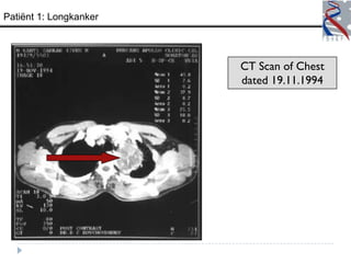 Patiënt 1: Longkanker




                        CT Scan of Chest
                        dated 19.11.1994
 