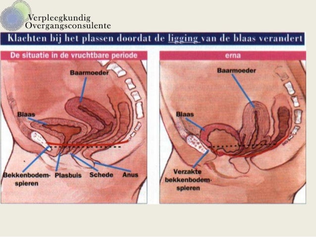 gewrichtspijn in de overgang