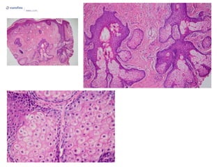 Presentatie pathologie basis_nmdl-lcpl | PPTX