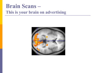 Brain Scans –
This is your brain on advertising
 
